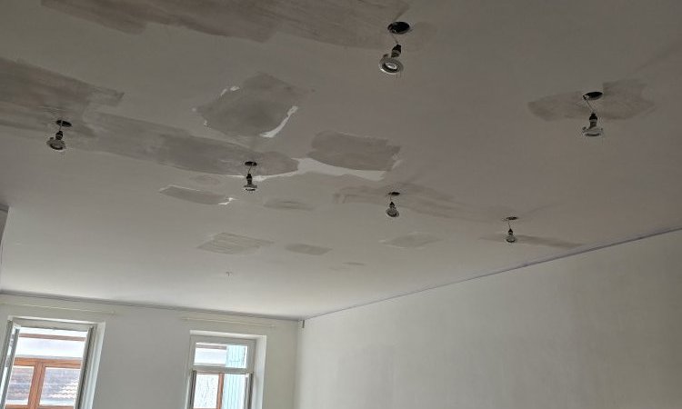 Pendant intervention 