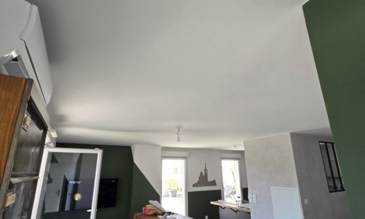 Après intervention 