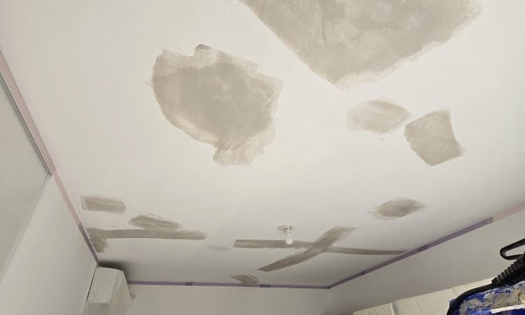 Pendant intervention 